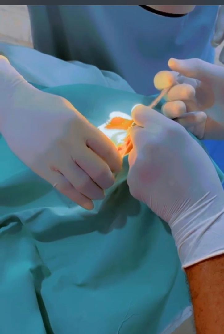 Eye surgeries